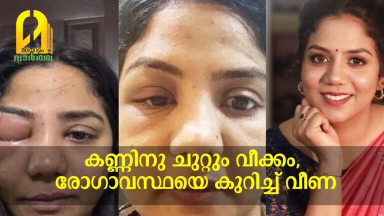 കണ്ണിനു ചുറ്റും വീക്കം,രോഗാവസ്ഥയെ കുറിച്ച് വീണ